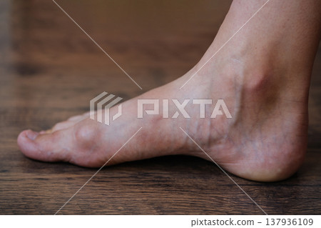 Foot On Floor. Natural Warm Light Highlights Sole And Vein Details During Inspection Foot On Floor. Natural Warm Light Highlights Sole And Vein Details During Inspection 137936109