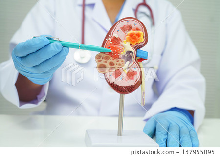 Chronic kidney disease, Asian woman with model for treatment urinary system, urology, Estimated glomerular filtration rate eGFR. Chronic kidney disease, Asian woman with model for treatment urinary system, urology, Estimated glomerular filtration rate eGFR. 137955095