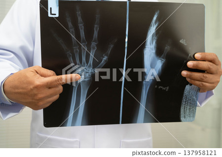 Doctor examining hand ankle joint bone radiography xray film. 137958121