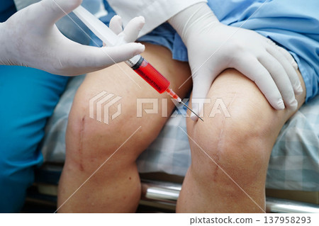 Asian doctor inject Hyaluronic acid platelet rich plasma into knee of senior woman. Asian doctor inject Hyaluronic acid platelet rich plasma into knee of senior woman. 137958293