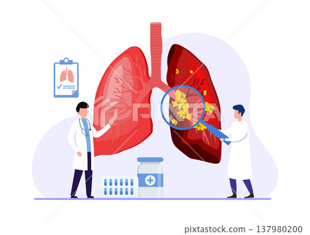 Doctors Examining Healthy and Diseased Lungs Stock Illustration 137980200