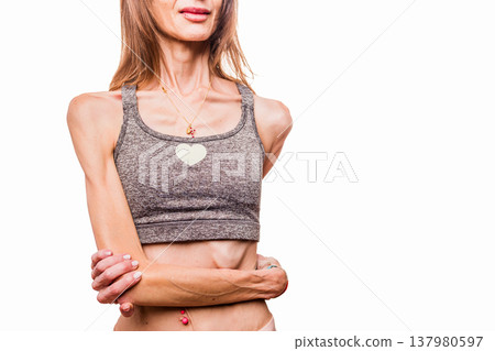 Woman with thin body suffering from anorexia nervosa 137980597