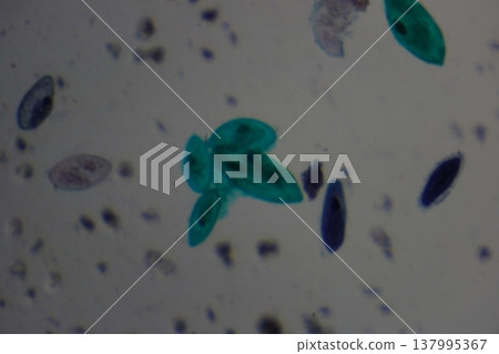 Paramecium Protozoa Under Microscope Examination Detail Paramecium Protozoa Under Microscope Examination Detail 137995367