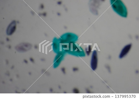 Paramecium Under Microscope Biology Protozoa and Cells Paramecium Under Microscope Biology Protozoa and Cells 137995370