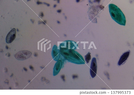 Paramecium Protozoa Observation with Microscope Paramecium Protozoa Observation with Microscope 137995373