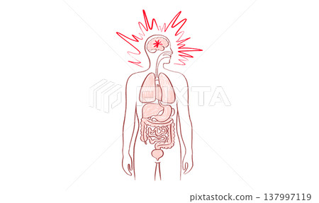 Brain disease concept 137997119