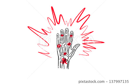 Arthritis Sketch Poster 137997135