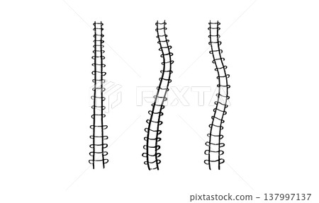 Scoliosis spine deformity Scoliosis spine deformity 137997137