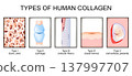 collagen types 137997707