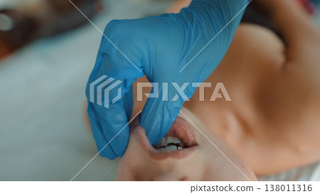 Medical specialist carefully examines lips and teeth during visit Medical specialist carefully examines lips and teeth during visit 138011316