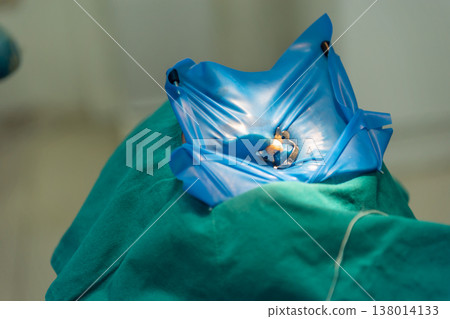 Closeup of dental isolation using rubber dam and clamp during treatment highlighting sterile procedure precision oral care and professional clinical environment 138014133