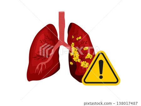 Human Lung Cancer Health Warning Disease Stock Illustration Human Lung Cancer Health Warning Disease Stock Illustration 138017487