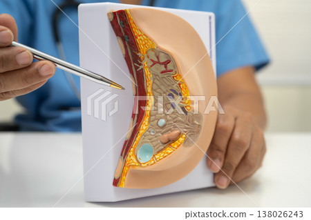 doctor holding female breast human anatomy model. 138026243