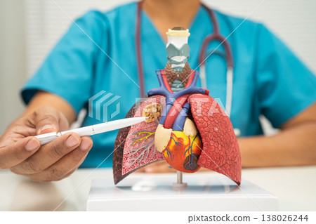 Pneumonia, lung cancer, Asian doctor holding human model. 138026244
