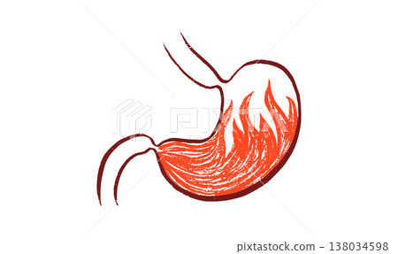 Gastroesophageal reflux pain Gastroesophageal reflux pain 138034598