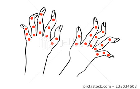 Arthritis Sketch Poster 138034608