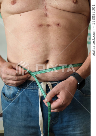 close-up of a fat man measuring his belly close-up of a fat man measuring his belly 138082301