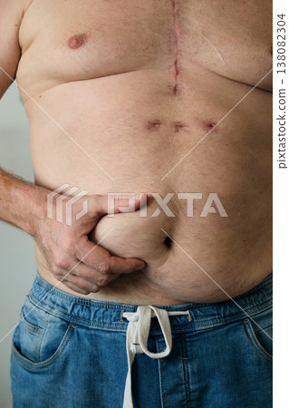 close-up of a fat man measuring his belly close-up of a fat man measuring his belly 138082304