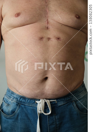 close-up of a fat man measuring his belly close-up of a fat man measuring his belly 138082305