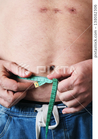 close-up of a fat man measuring his belly close-up of a fat man measuring his belly 138082306
