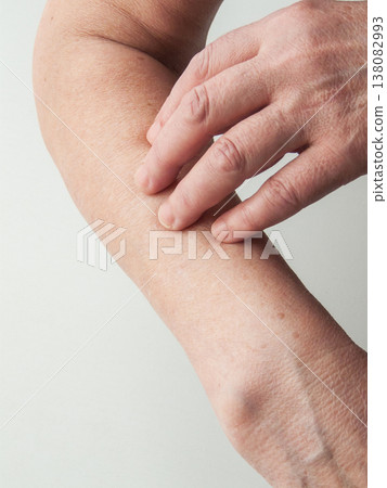 Senior woman touching showing dry skin on arm, dehydration and seasonal disease, aging symptoms. 138082993