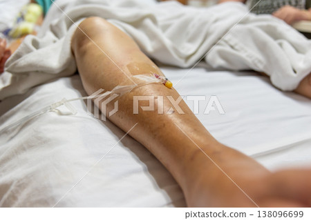 Close up of patient arm with IV catheter on hospital bed highlighting medical treatment recovery care monitoring and clinical environment with soft fabric and copy space 138096699