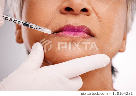Mouth needle, plastic surgery hands and woman with closeup surgeon augmentation, lip filler or silicone treatment. Studio spa clinic, collagen injection and client transformation on white background 138104281