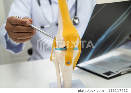 Doctor examining knee joint bone radiography xray film. 138117412