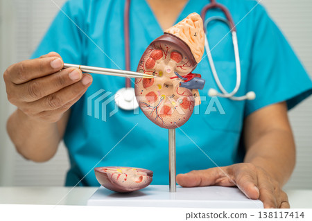 Chronic kidney disease, doctor with model for treatment urinary system, urology, Estimated glomerular filtration rate eGFR. 138117414