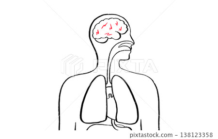 Brain disease concept 138123358