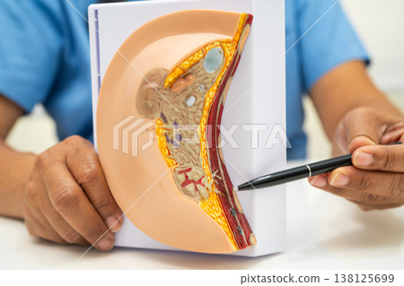 doctor holding female breast human anatomy model. doctor holding female breast human anatomy model. 138125699