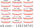 Illustrations of teeth alignment and bite 138138745