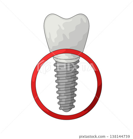 Illustration of dental implant 138144739