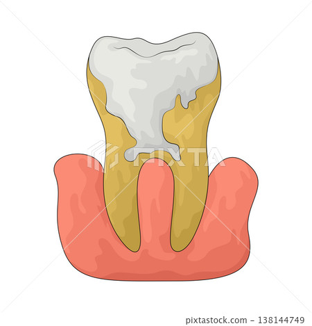 Illustration of Dental Disorders Illustration of Dental Disorders 138144749