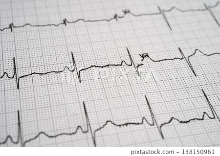 Red heart on electrocardiogram ECG with red heart, heart wave, heart attack, cardiogram report. Red heart on electrocardiogram ECG with red heart, heart wave, heart attack, cardiogram report. 138150961