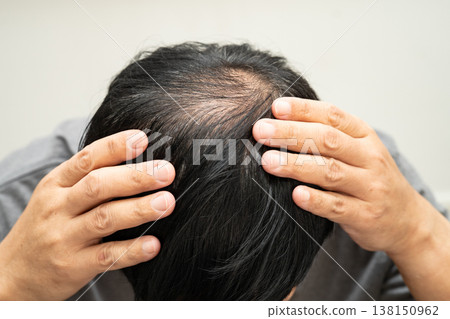 Bald in the middle head and begin no loss hair glabrous of mature Asian business smart active office man. Bald in the middle head and begin no loss hair glabrous of mature Asian business smart active office man. 138150962