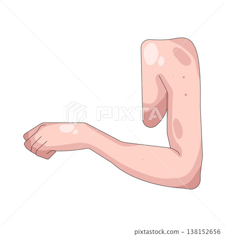 Illustration of human elbow Illustration of human elbow 138152656