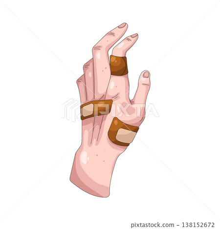 Illustration of hand injury Illustration of hand injury 138152672