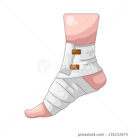 Illustration of broken leg Illustration of broken leg 138152673