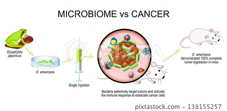 Microbiome and cancer. Cancer therapy. Experimental oncology. Microbiome and cancer. Cancer therapy. Experimental oncology. 138155257