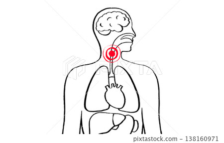 Throat inflammation pain 138160971