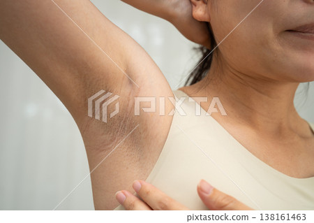 Asian woman have problem black armpit beauty skin care. Asian woman have problem black armpit beauty skin care. 138161463