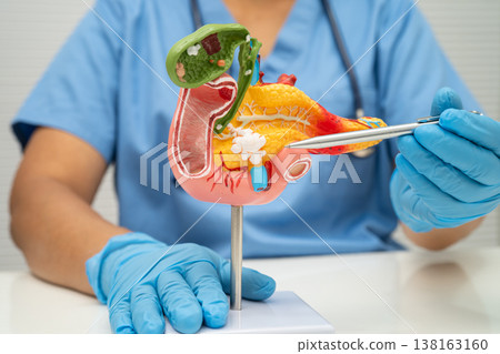 Pancreatitis, pancreatic cancer, Asian doctor with pancreas, gallbladder and bile duct human anatomy model at hospital. 138163160