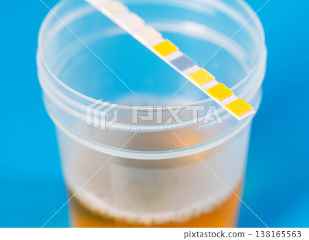 A test strip on a container with urine reflecting the degree of acidity of urine and the degree of inflammation in the urinary tract, close-up. 138165563