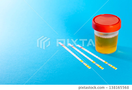 Test strips on a blue background with a urine test jar. Concept of rapid urine analysis with test strips for determining the density and acidity of urine, as well as red and white blood cells in the Test strips on a blue background with a urine test jar. Concept of rapid urine analysis with test strips for determining the density and acidity of urine, as well as red and white blood cells in the 138165568