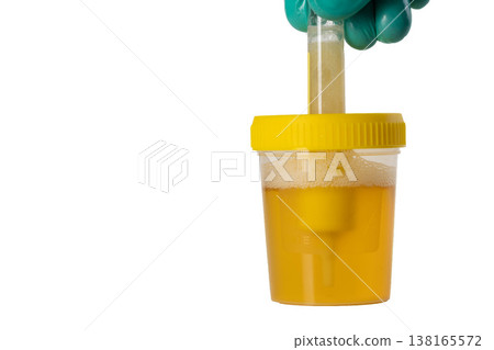 Transferring urine into a transport tube with reagents for bacterial culture testing, white background. Diagnosis of bacterial infections and microorganisms with antibiotic sensitivity. Copy space for Transferring urine into a transport tube with reagents for bacterial culture testing, white background. Diagnosis of bacterial infections and microorganisms with antibiotic sensitivity. Copy space for 138165572