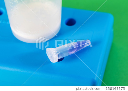 Sperm analysis of prostate fluid and ejaculate for infection and microscopy. Male infertility, presence of motile sperm, close-up Sperm analysis of prostate fluid and ejaculate for infection and microscopy. Male infertility, presence of motile sperm, close-up 138165575