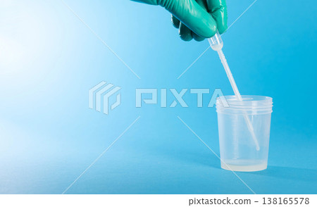 A laboratory technician collects prostate fluid in a test tube to test for flora and antibiotic sensitivity of infections. Leukocytes in prostate fluid, prostatitis. Copy space for text A laboratory technician collects prostate fluid in a test tube to test for flora and antibiotic sensitivity of infections. Leukocytes in prostate fluid, prostatitis. Copy space for text 138165578