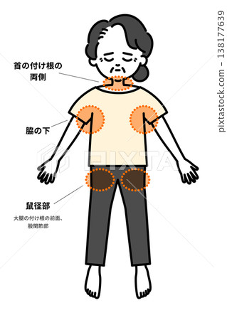 中暑時需要降溫的身體部位 中暑時需要降溫的身體部位 138177639
