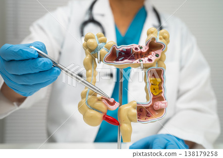 Intestine, appendix and digestive system, doctor holding anatomy model for study diagnosis and treatment in hospital. 138179258